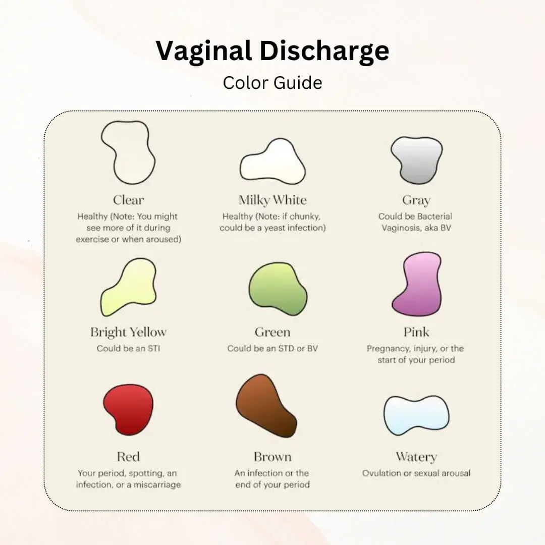 Color guide of vaginal discharge